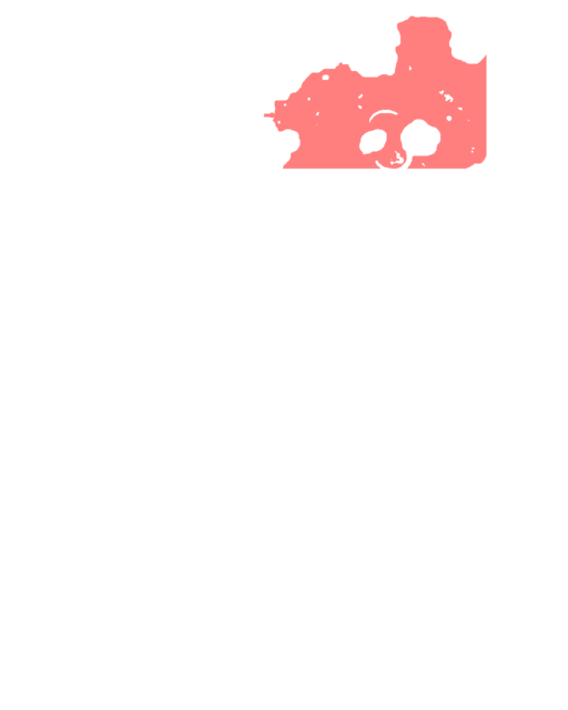 Localização Metin Negra Amarelos.png
